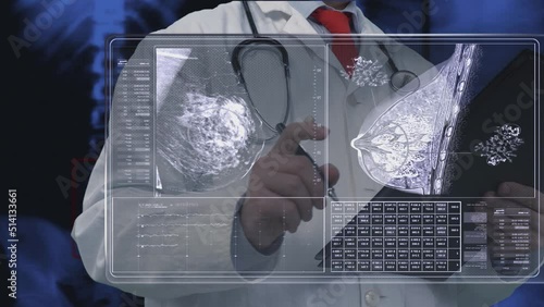 Breast Cancer analysis