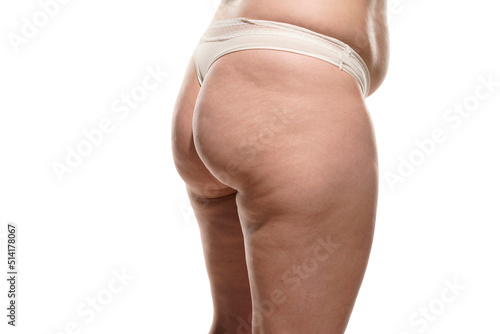 Side view of overweight woman with fat cellulite legs, belly and buttocks, obesity female body, white background