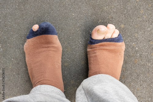 Male legs with protruding toes in holey worn socks, on a gray floor. Top view. 