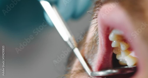 Cllose-up. Dentist wearing medical gloves examines the oral cavity of a male patient with the help of a dental mirror in a modern dental clinic