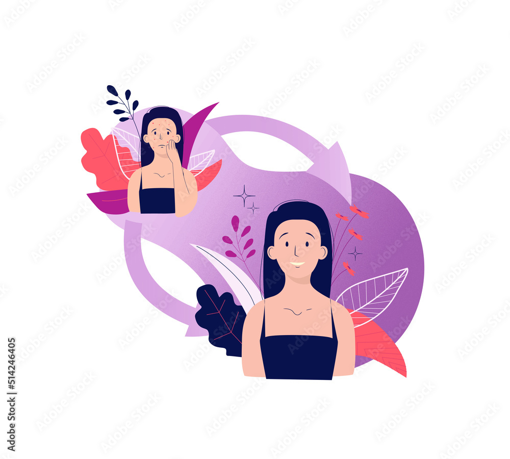 Poster with a woman with problem skin and healthy skin. Facial skin care. Vector illustration Poster with a woman with problem skin and healthy skin. Facial skin care. Vector illustration
