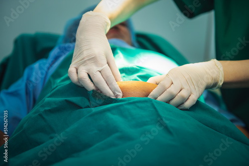 Woman doctor using a hand to hold the belly fat Of obese woman patients, who received treatment for abdominal fat reduction surgery from obesity, to people health care and surgery concept. photo