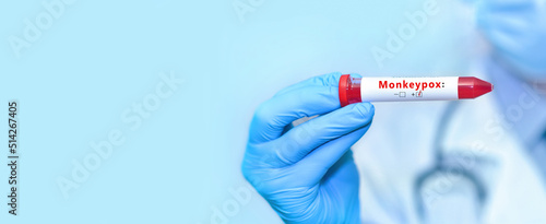 Doctor holding a test blood sample tube with positive monkey pox virus (MPXV).Banner. Copy space for text photo