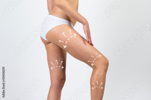 Cellulite removal on body and legs woman. Young girl with beautiful and healthy body concept.