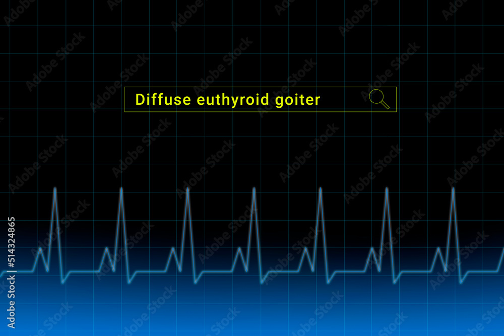 Diffuse euthyroid goiter.Diffuse euthyroid goiter inscription in search bar. Illustration with titled Diffuse euthyroid goiter . Heartbeat line as a symbol of human disease. Diffuse euthyroid goiter.Diffuse euthyroid goiter inscription in search bar. Illustration with titled Diffuse euthyroid goiter . Heartbeat line as a symbol of human disease.