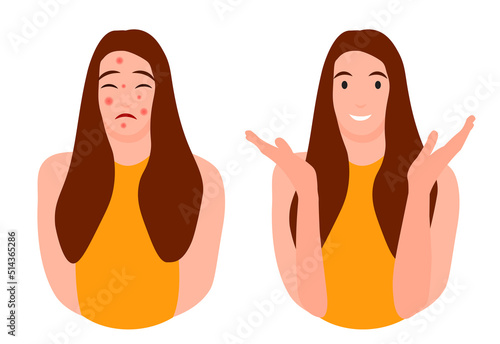 Cartoon teenage girl character with and without acne. Skin problems concept. Colorful vector illustration isolated on white background. Medicine, beauty and health care.