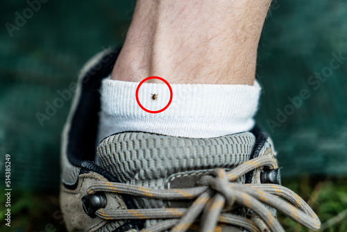 Australian bush tick sitting on a sog on a human leg. Cattle tick dangerous to human. Hiking photo