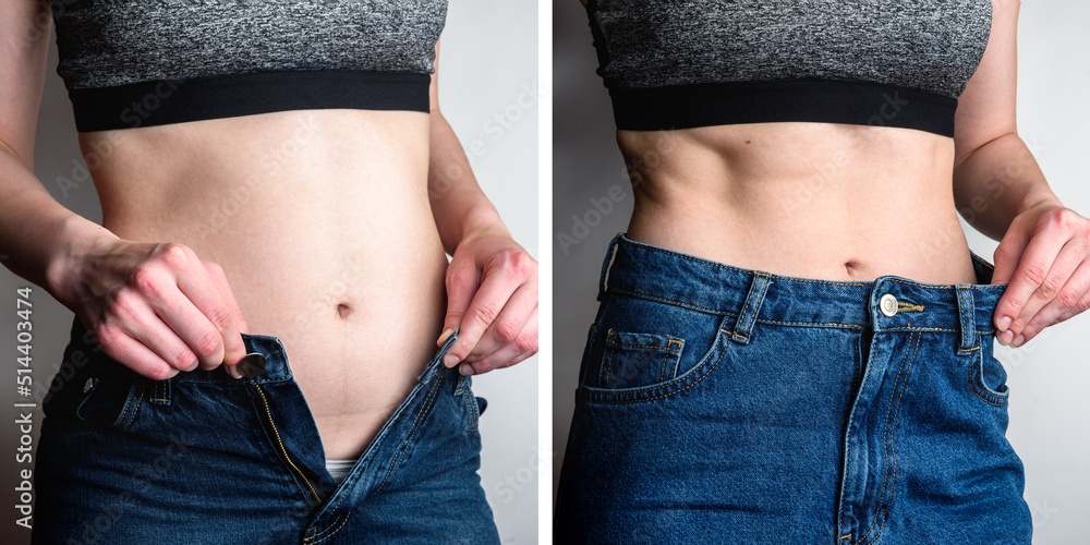 Female body before and after weight loss, diet concept. Woman is ...
