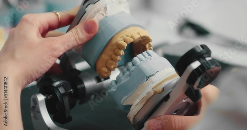 Dental technician makes a plaster cast of jaw models in an articulator. Production of a dental implant in a dental laboratory