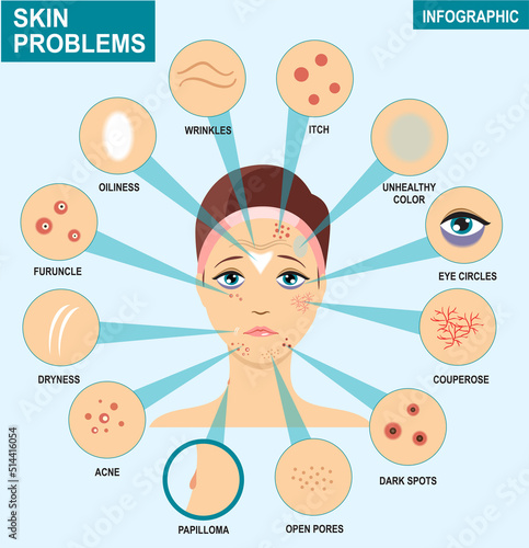 Skin problems infographics. Woman and set of the most common skin problems should take care of acne, wrinkles, dry skin, acne, dark circles under the eyes.