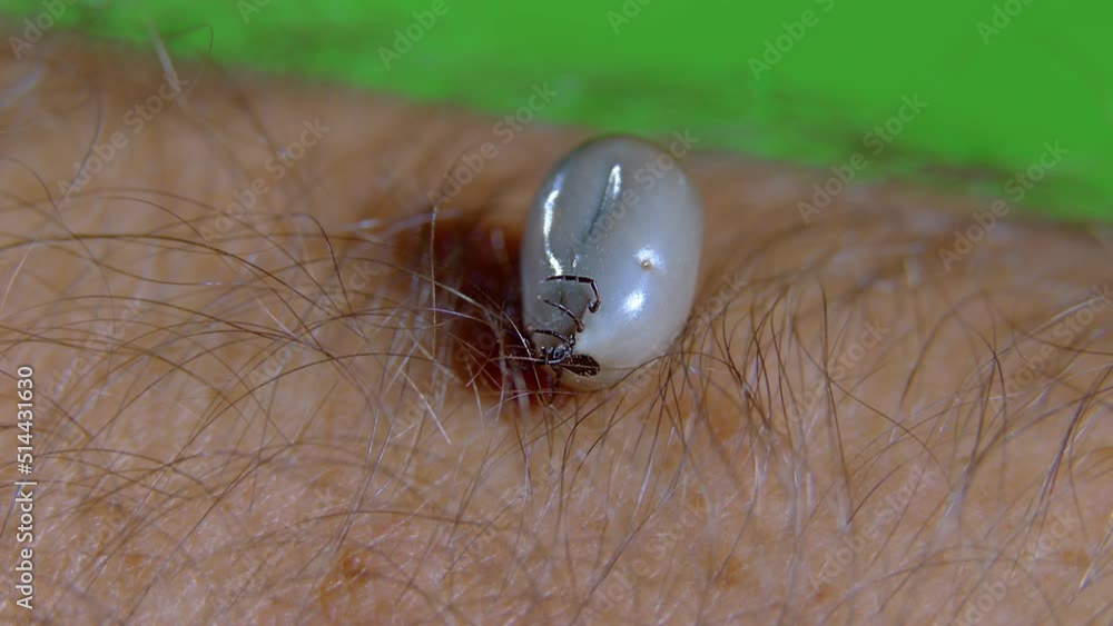 tick, encephalitis, lyme, parasite, human, sting, dangerous, mite