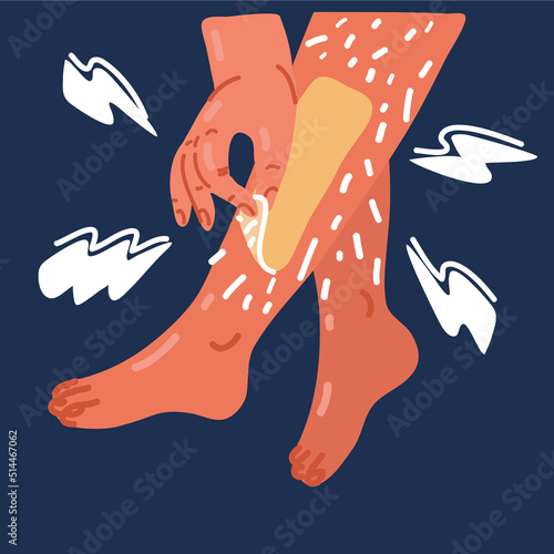 Cartoon vector illustration of depilatory wax to a young woman's leg for hair removal. Depilation with wax. Beauty concept.