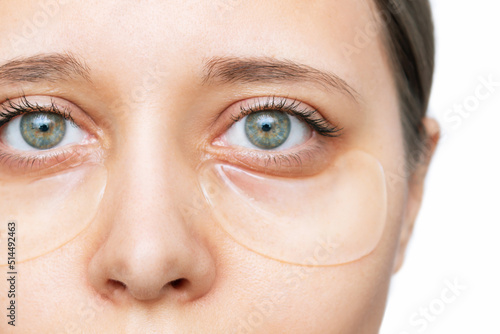 Close-up of a young caucasian woman with gel colorless transparent patches on the skin under her eyes isolated on a white background. Skin care, cosmetology