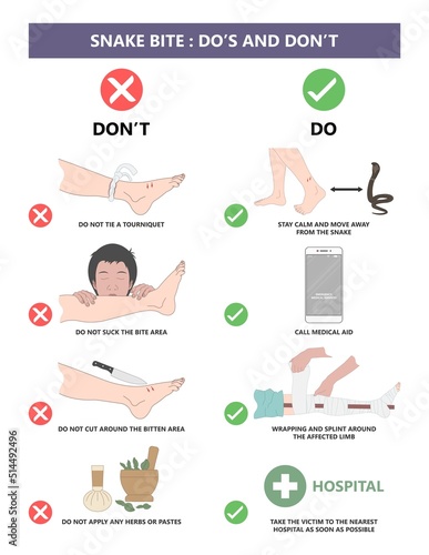 Snake Bite First Aid care non venomous anti venom serum hand leg king cobra treat kit death injury help safe call pain blood healing prevent coral fangs step poster grabbing splint limb sign tongs