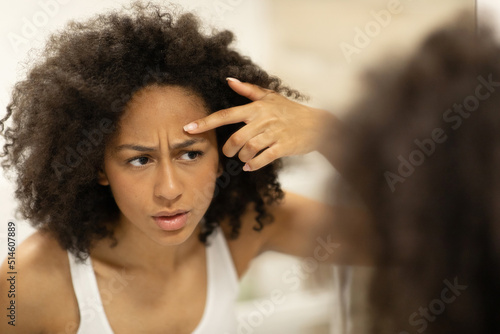 Unhappy black woman with problem skin squeezing a pimple on her forehead, suffering from acne