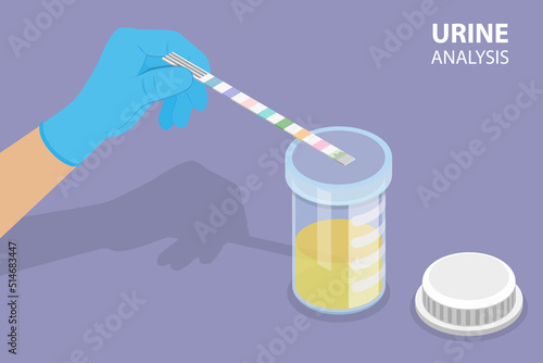 3D Isometric Flat Vector Conceptual Illustration of Urine Analysis, Lab Test
