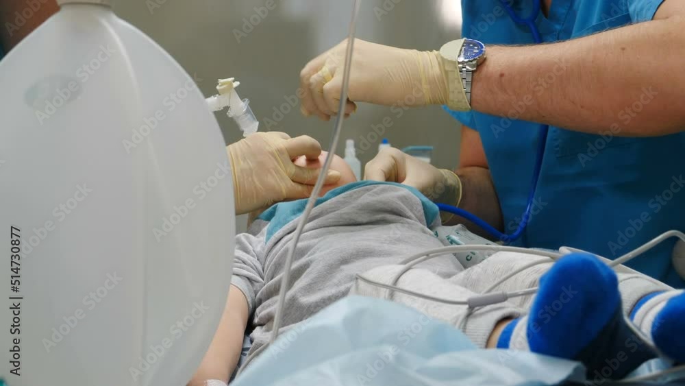 Dental treatment on child under general anesthesia. Breathing mask on boy face. Healthcare and life saving. Breathing tube and mask in mouth of kid. Preparing for surgery. Operation in clinic. 4 k Dental treatment on child under general anesthesia. Breathing mask on boy face. Healthcare and life saving. Breathing tube and mask in mouth of kid. Preparing for surgery. Operation in clinic. 4 k