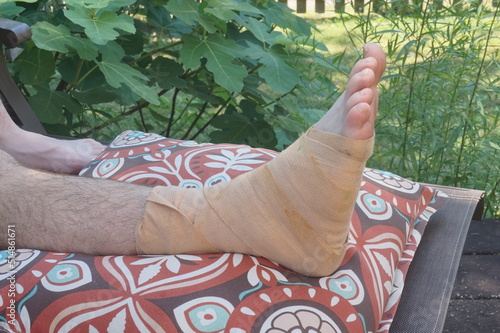 Injured Foot Wrapped in Ace Bandage Elevated on Pillow by Fig Tree in Summer photo