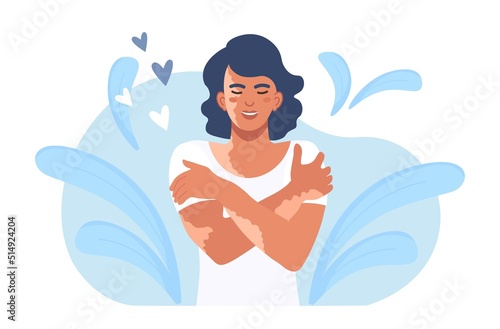Woman hugging herself with skin problems, disease. Happy girl with vitiligo hugs herself by the shoulders. World vitiligo day. Person loves her body. Self care and self love. Vector design