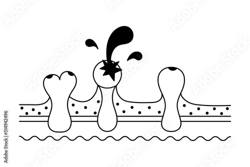Pimples on the skin. The furuncle has matured and burst. Silhouettes of splashes of pus fly in different directions. Vector illustration. Section of the subcutaneous layers. 