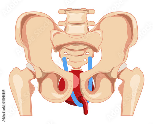 Urinary incontinence tension-free vaginal tape TVT female stress urinary incontinence therapy Female system Front view is skeleton pelvis. Human anatomy location scheme flat style icon isolated
