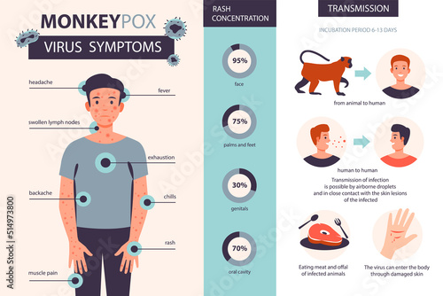 Monkey pox virus symptoms infographic. It cause skin infections. Headache, fever, rash in the patient. Flat vector illustration photo