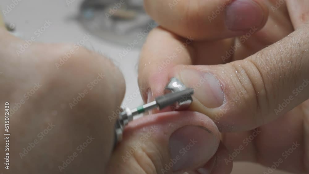 Using Instrument For Metal Polishing To Produce Dental Crown. Instrument Producing Crown For Tooth Restoration. Dentistry Technician Uses Instrument For Dental Crown Production. Stomatology Using Instrument For Metal Polishing To Produce Dental Crown. Instrument Producing Crown For Tooth Restoration. Dentistry Technician Uses Instrument For Dental Crown Production. Stomatology
