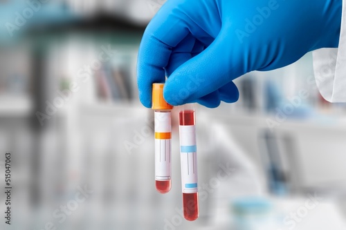Blood samples of patient for test in laboratory. Blood tubes photo