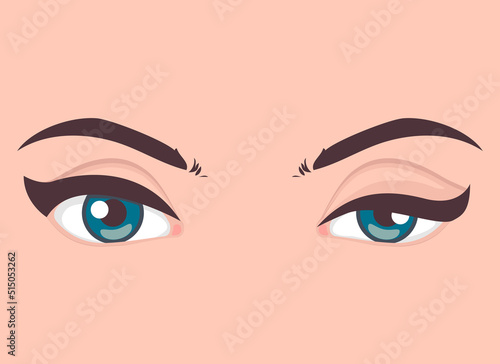 Ptosis of the upper eyelid, optical problem with eye, medical vector illustration