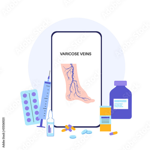 Varicose veins treatment
