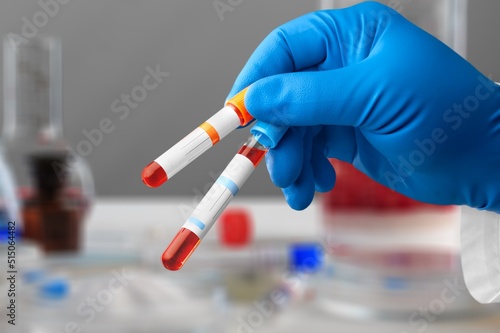 Blood sample of patient for complete screening test in laboratory. doctor with Blood tube and catheter