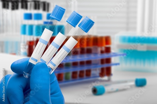 фотографія Blood sample of patient for complete screening test in laboratory