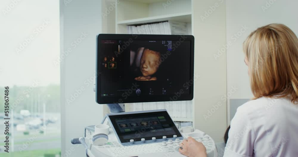 Ultrasound diagnosis of fetal development in a modern clinic Ultrasound diagnosis of fetal development in a modern clinic