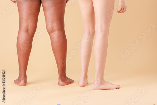 legs for skincare depilation hygiene. interracial women Moroccan and young Latin unretouched photo