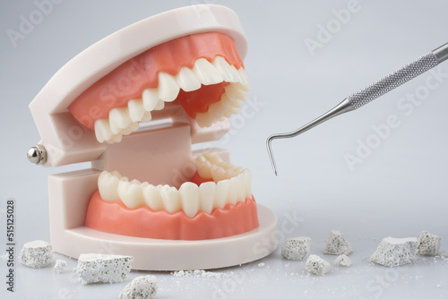 Teeth model with dental plaque tool ,Concept Dental care cleaning bacterial plaque and scaling tartar