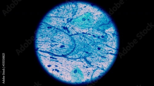 AFB Negative and Positive in stop motion footage.