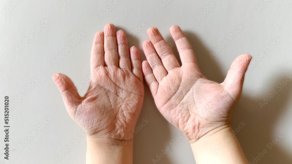 The photo palm child of three years , which wrinkled and shriveled due to the long stay in the water and swim , pink palm on a blur background. The photo palm child of three years , which wrinkled and shriveled due to the long stay in the water and swim , pink palm on a blur background.