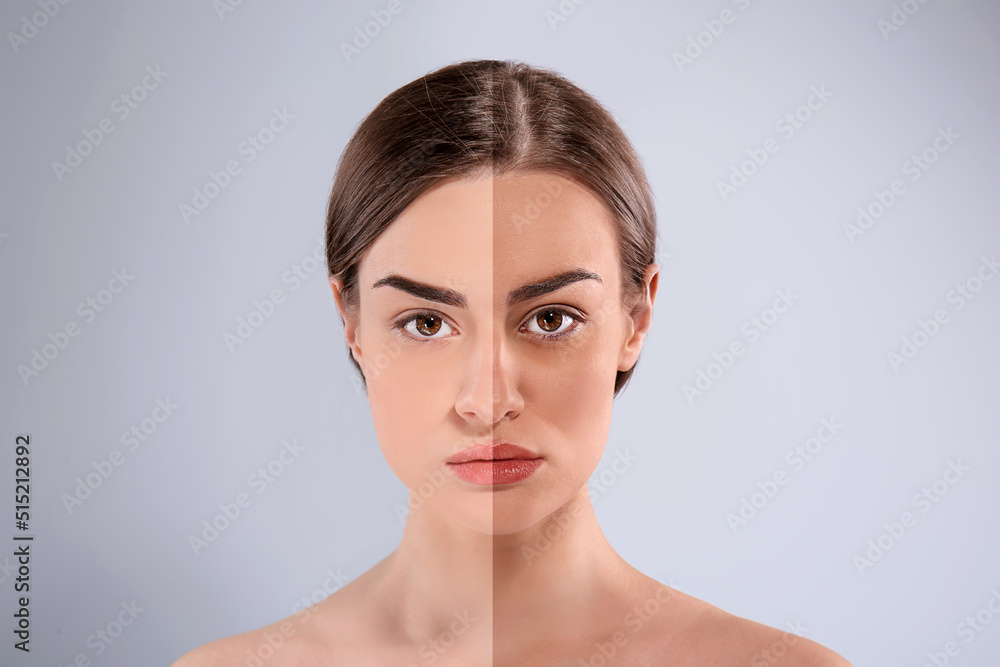 Collage with photos of beautiful young woman before and after tanning on light grey background Collage with photos of beautiful young woman before and after tanning on light grey background