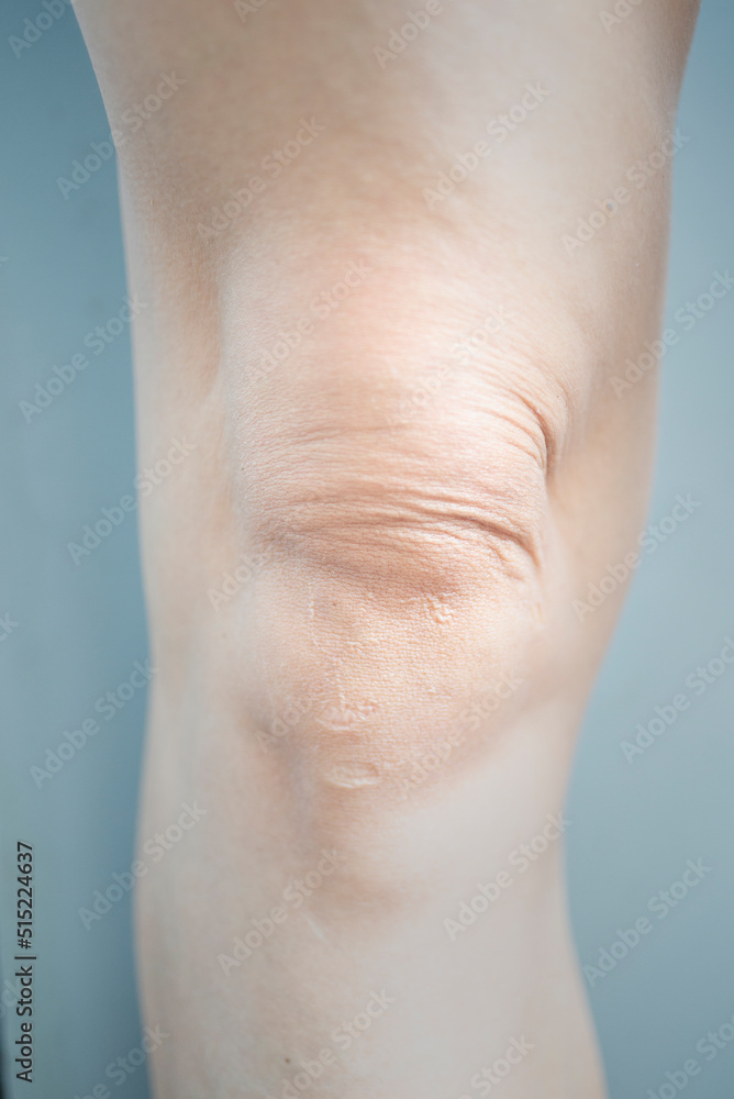 Fototapeta premium close up of a person with a pain