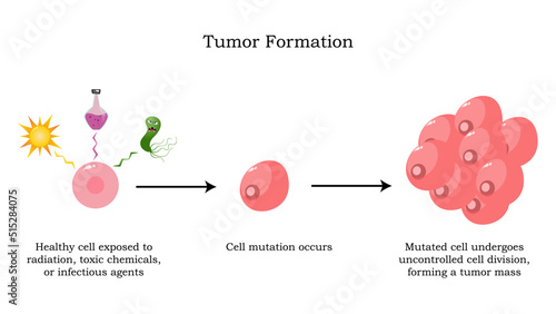 Tumor formation from mutated cells photo