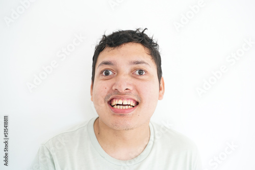 Portrait of smiling asian handicapped man