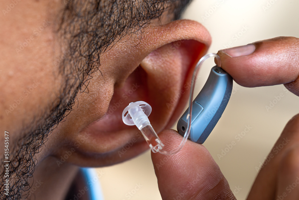Fototapeta premium Hearing disorders-Hearing pothesis . Hearing aids