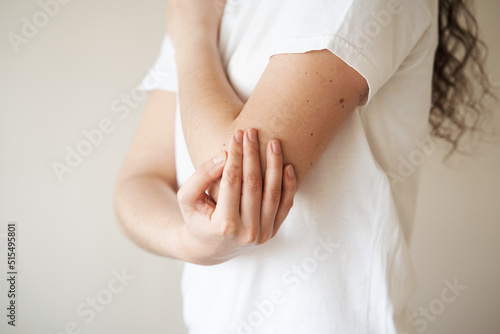 Elbow injury. Beautiful girl with pain and bruise in her arm due to an accident. Traumatology.