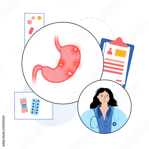 Stomach polyp disease