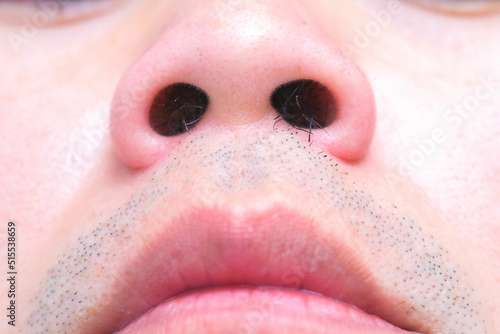 Billede på lærred young man's nose His nostrils are hairy
