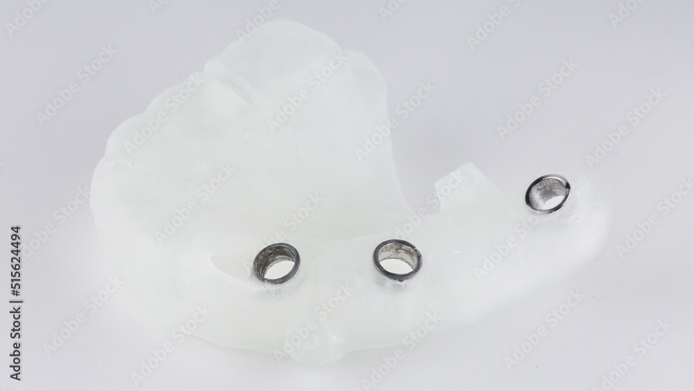 excellent dental template on a white background for the installation of three implants excellent dental template on a white background for the installation of three implants