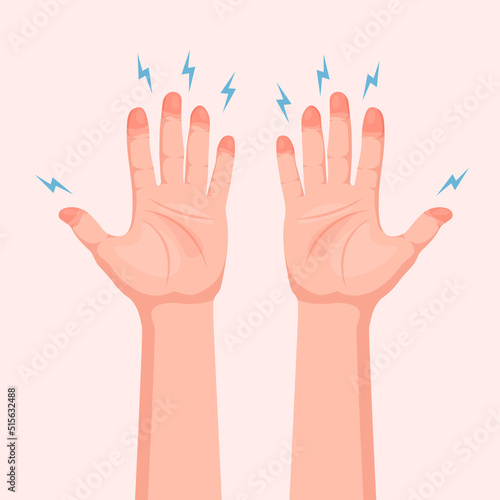 Frozen hands with fingers. Medical frostbite. Skin burn symptom. Vector illustration isolated.