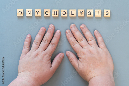 Onycholysis nail. The inscription Onycholysis in wooden letters on a gray background photo