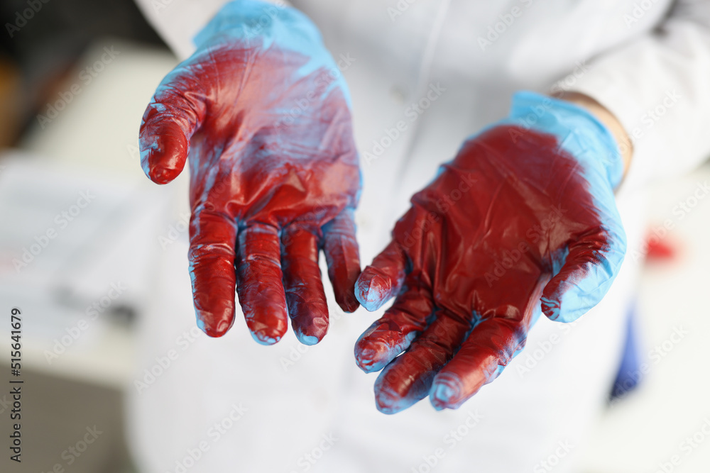 Surgeon in blue gloves with blood closeup