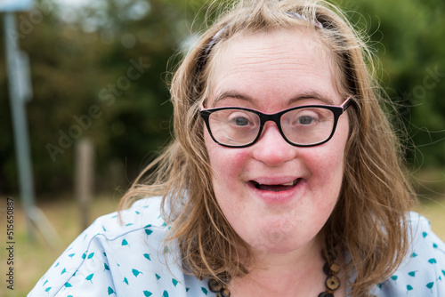 Portrait of a cute 38 year old girl with Down Syndrome,